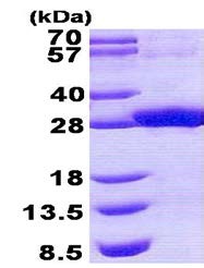SDS-PAGE - Recombinant Human RDHE2 protein (AB140552)