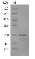SDS-PAGE - Recombinant Human Recoverin protein (His tag) (AB241240)