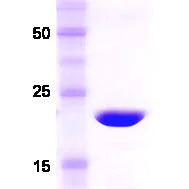 SDS-PAGE - Recombinant Human Recoverin protein (Tag Free) (AB48757)