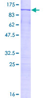 SDS-PAGE - Recombinant Human RED1 protein (AB157847), expandable thumbnail