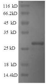 SDS-PAGE - Recombinant Human Reelin protein (His tag) (AB236169)