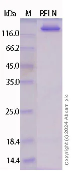 SDS-PAGE - Recombinant Human Reelin Protein Standard (His tag) (AB316426)