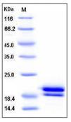 SDS-PAGE - Recombinant Human REG1B protein (His tag) (AB276414)