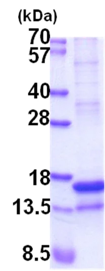 SDS-PAGE - Recombinant Human REG4 protein (denatured) (T7 tag N-Terminus) (AB202197)