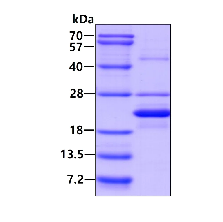 SDS-PAGE - Recombinant Human Relaxin 2/RLN2 protein (denatured) (His tag N-Terminus) (AB139240)
