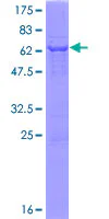 SDS-PAGE - Recombinant Human Renalase protein (AB132381)