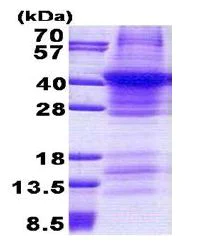 SDS-PAGE - Recombinant Human Renin protein (denatured) (His tag N-Terminus) (AB168875)