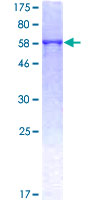 SDS-PAGE - Recombinant Human Renin Receptor protein (AB153053)