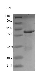 SDS-PAGE - Recombinant Human Renin Receptor protein (His tag) (AB235066)