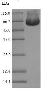 SDS-PAGE - Recombinant Human Reptin/TIP49B/RUVB2 protein (His tag) (AB225966)