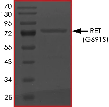 SDS-PAGE - Recombinant human Ret (mutated G691S) protein (AB186461)