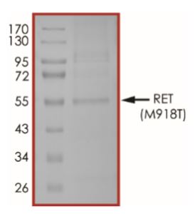 SDS-PAGE - Recombinant human Ret (mutated M918T) protein (Tagged-His Tag) (AB268923), expandable thumbnail