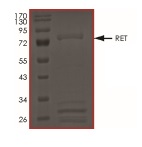 SDS-PAGE - Recombinant human Ret (mutated R813Q) protein (AB186456), expandable thumbnail