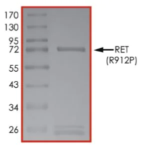SDS-PAGE - Recombinant human Ret (mutated R912P) protein (Active) (AB268924)