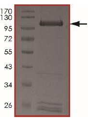 SDS-PAGE - Recombinant human Ret + PRKAR1A protein (AB204148), expandable thumbnail
