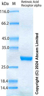 SDS-PAGE - Recombinant Human Retinoic Acid Receptor alpha Protein Standard (His tag) (AB316714)