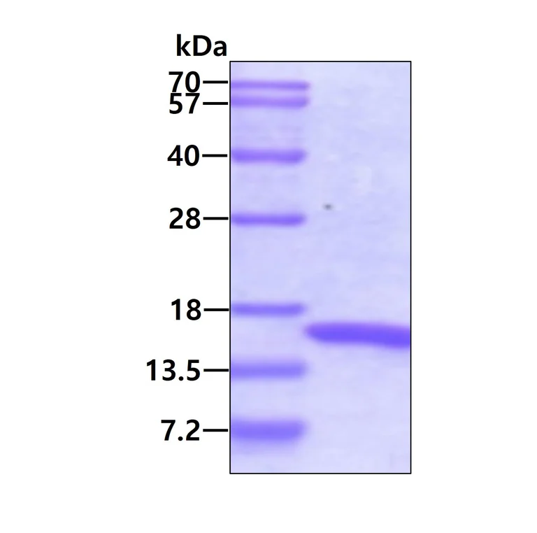 SDS-PAGE - Recombinant Human Retinoid X Receptor alpha/RXRA protein (Tag Free) (AB48737)