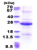 SDS-PAGE - Recombinant Human REXO1 protein (His tag N-Terminus) (AB177672)