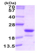 SDS-PAGE - Recombinant Human RFK protein (AB89009)