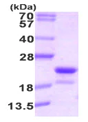 SDS-PAGE - Recombinant Human RFK protein (His tag N-Terminus) (AB89009)