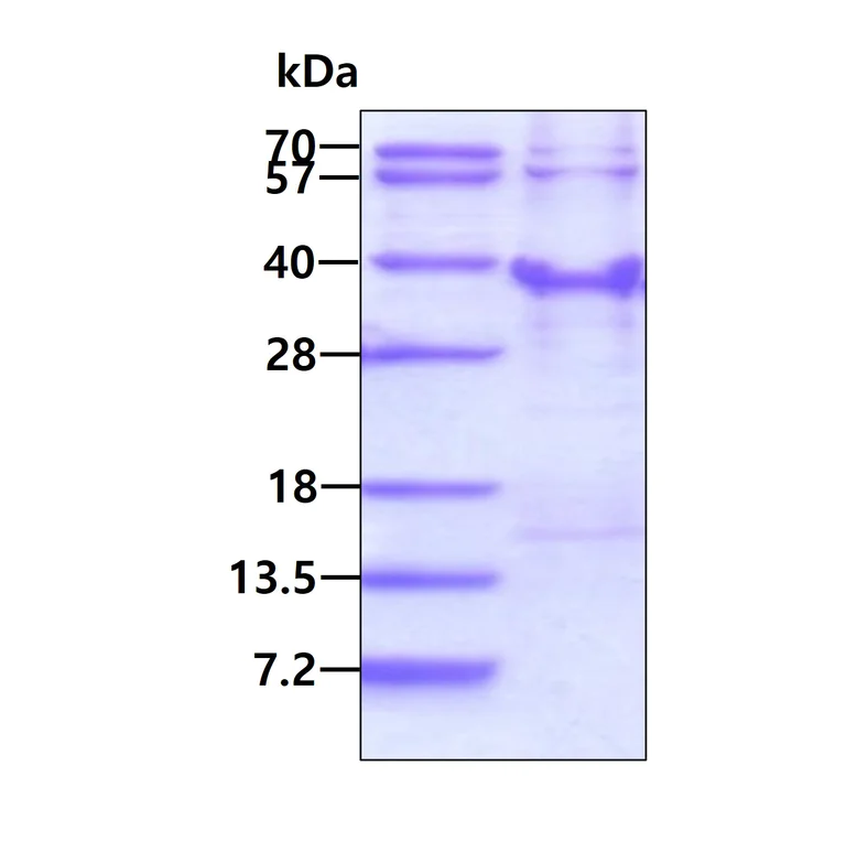 SDS-PAGE - Recombinant Human RFXANK protein (His tag N-Terminus) (AB167884)