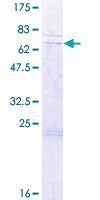 SDS-PAGE - Recombinant Human RGD1310794 protein (AB164485)