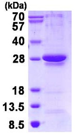 SDS-PAGE - Recombinant Human RGS1 protein (AB126697), expandable thumbnail