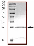 SDS-PAGE - Recombinant Human RGS1 protein (AB89814)