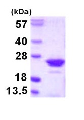 SDS-PAGE - Recombinant Human RGS10 protein (His tag N-Terminus) (AB109947)