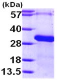 SDS-PAGE - Recombinant Human RGS19 protein (AB101949), expandable thumbnail