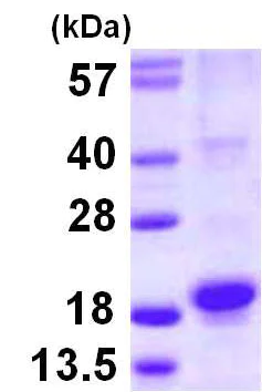 SDS-PAGE - Recombinant Human RGS21 protein (His tag N-Terminus) (AB116158)