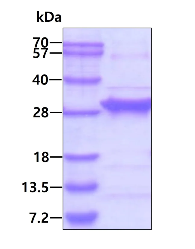 SDS-PAGE - Recombinant Human RGS4 protein (AB113136)