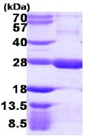 SDS-PAGE - Recombinant Human RGS5 protein (AB113146), expandable thumbnail
