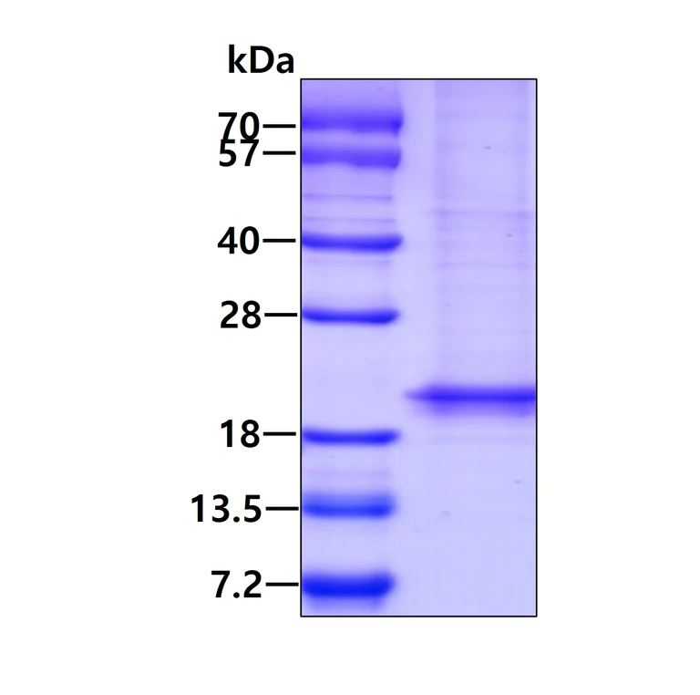 SDS-PAGE - Recombinant Human RHEB protein (AB78768)