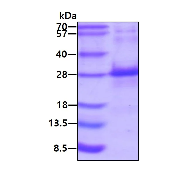 SDS-PAGE - Recombinant Human RHOB protein (AB107139)
