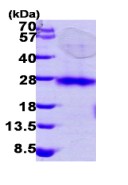 SDS-PAGE - Recombinant Human RHOC protein (His tag N-Terminus) (AB98085)