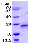 SDS-PAGE - Recombinant Human RHOD protein (AB105608), expandable thumbnail