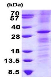 SDS-PAGE - Recombinant Human RhoV protein (denatured) (His tag N-Terminus) (AB131677)