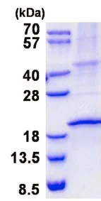 SDS-PAGE - Recombinant Human Ribonuclease 3/ECP protein (denatured) (His-DDDDK tag N-Terminus) (AB137138)