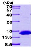 SDS-PAGE - Recombinant Human RIDA protein (His tag N-Terminus) (AB101632)