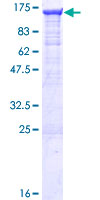 Recombinant Human RIG-I/DDX58 protein