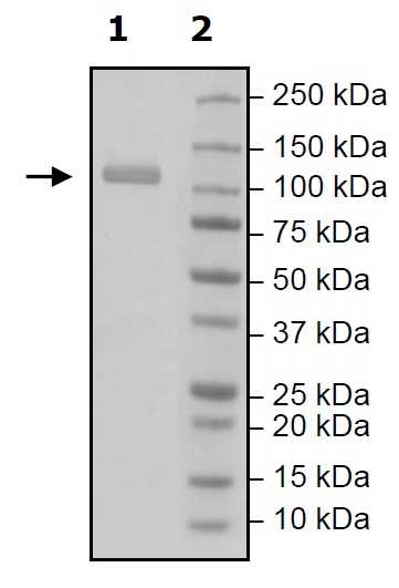Western blot - Recombinant Human RIG-I/DDX58 protein (DDDDK tag N-Terminus) (AB271486)