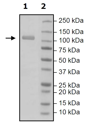 Western blot - Recombinant Human RIG-I/DDX58 protein (Tagged) (AB271486)