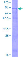 Recombinant Human RING1 protein