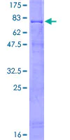 SDS-PAGE - Recombinant Human RING1 protein (AB112348)