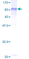 Recombinant Human RIO2 protein (Tagged)