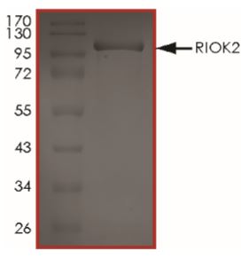 SDS-PAGE - Recombinant Human RIO2 protein (Tagged) (AB268940), expandable thumbnail