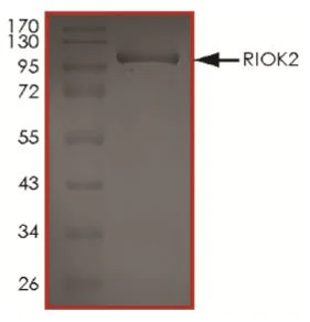 SDS-PAGE - Recombinant Human RIO2 protein (Tagged) (AB268940)
