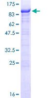 SDS-PAGE - Recombinant Human RIOK1/RIO1 protein (AB164432)