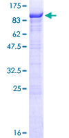 SDS-PAGE - Recombinant Human RIOK1/RIO1 protein (GST tag N-Terminus) (AB164432)